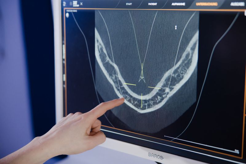 3D-DVT Röntgendiagnostik